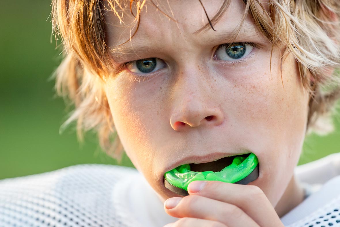 https://www.renewdentalgr.com/images/pages/7-facts-about-your-sports-mouth-guard-grand-rapids-dentist@2x.jpg